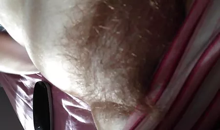רופאים טיפלו פארטיפורנו בחולה עם איברים עבים.